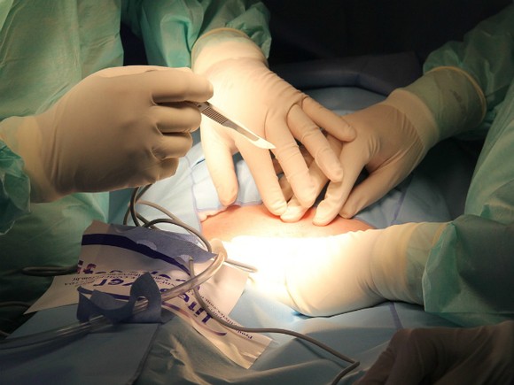 В больнице РЖД женщине по ошибке удалили грудь - «Экономика»