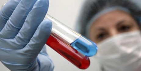 Ученые приблизились к созданию вакцины от ВИЧ - «Спорт»